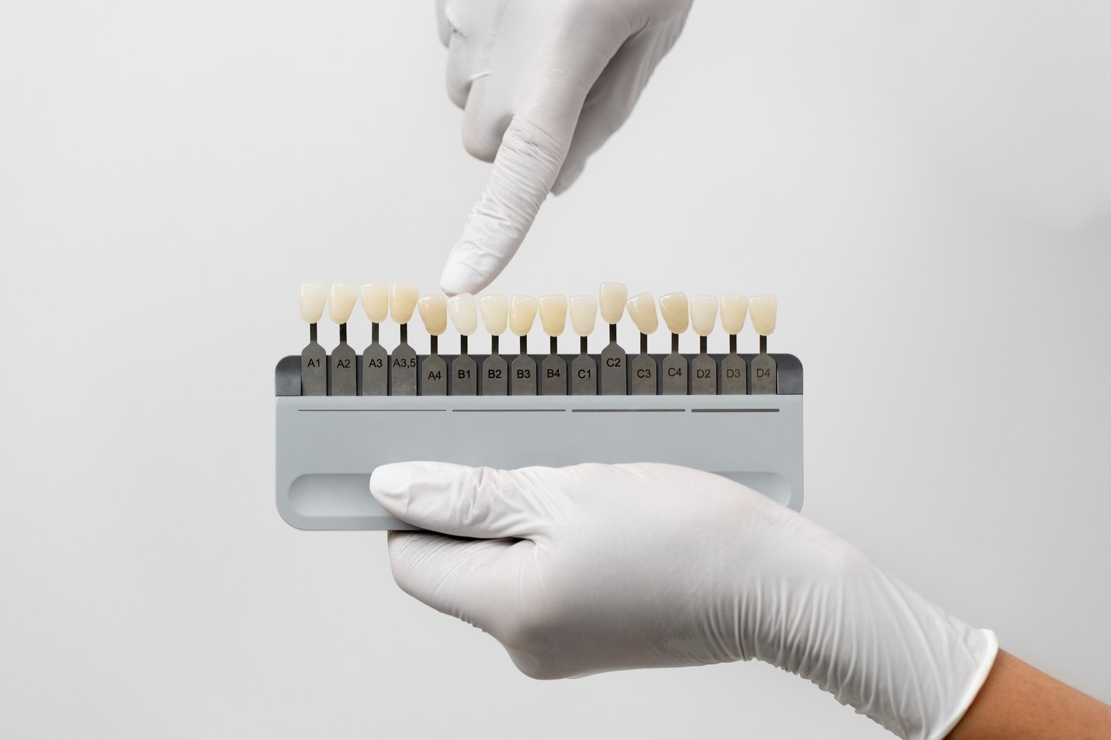 Turkey teeth veneers – High-quality dental veneers for a perfect smile